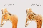 بیماری خاموش را جدی بگیرید