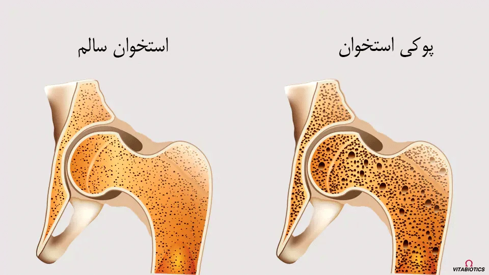 بیماری خاموش را جدی بگیرید